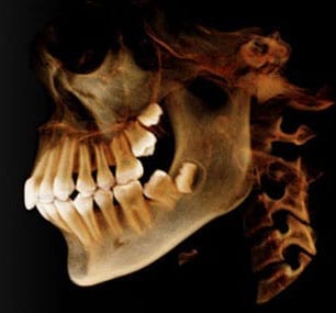 Anatomage-x-ray-left