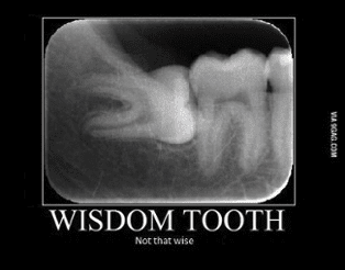 Capitol Center® - Tips for Planning Wisdom Teeth Removal Before Your Child Heads Back-to-School