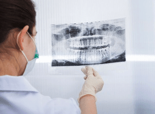 Capitol Center® - What Is Image Guided Dental Implant Surgery?