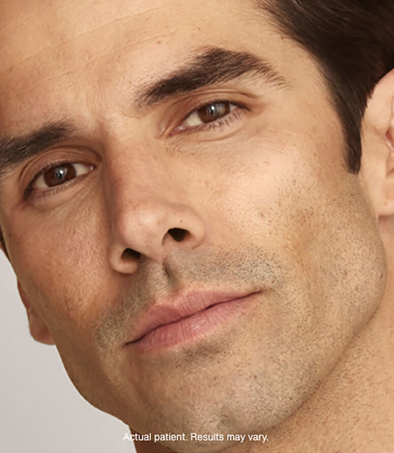 Actual Patient Results