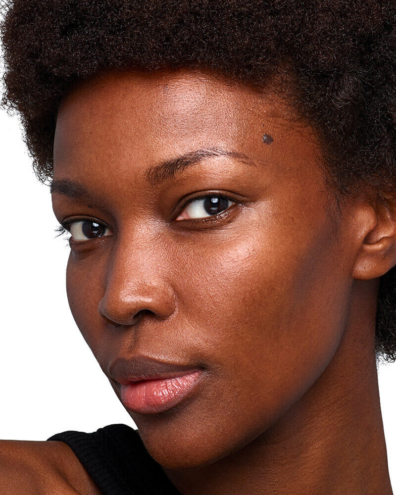 Skinvive patient before