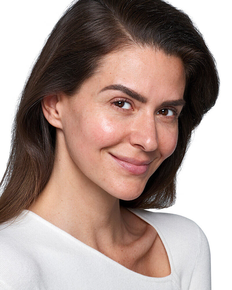 Skinvive patient after 2