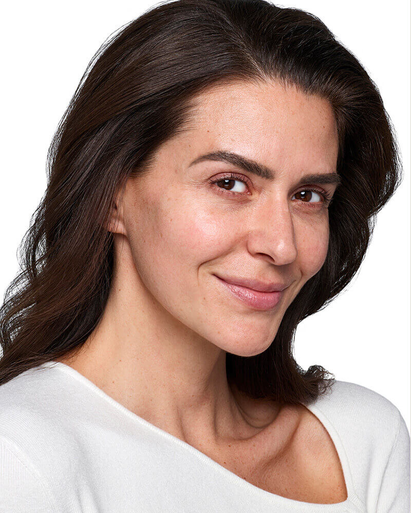 Skinvive patient before 2