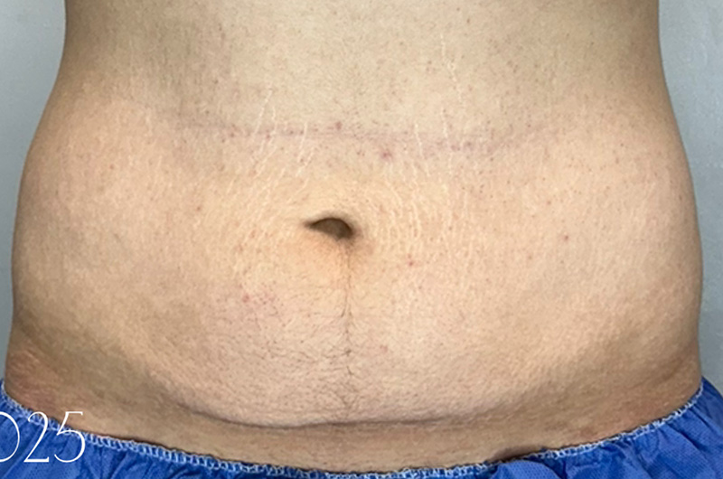 Case--9592 | After Morpheus 8 1