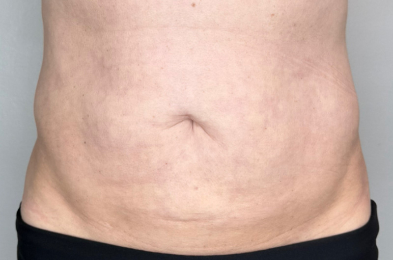 Case--2304 | After Morpheus 8 1