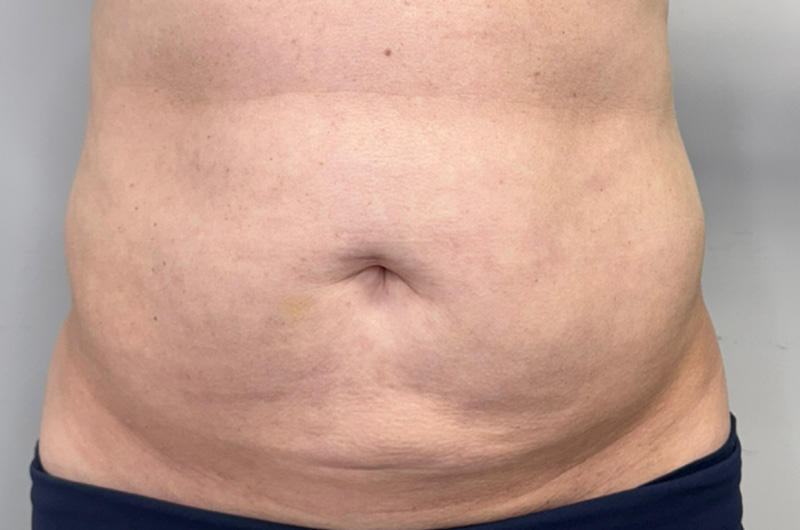 Case--2304 | Before Morpheus 8 1