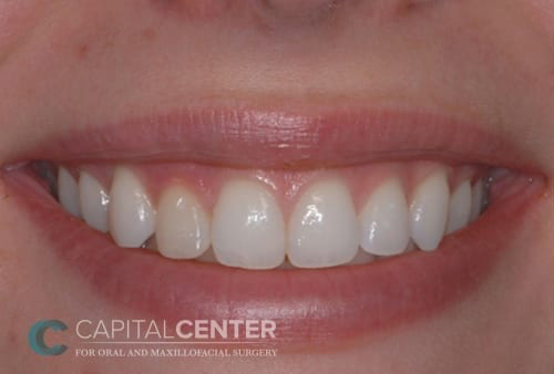 Case--3634 | Before Oral 1