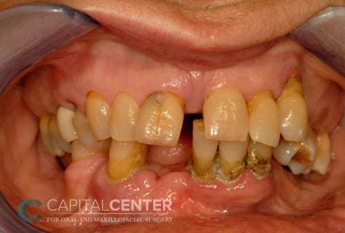 Case--7390 | Before Oral 1