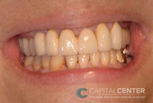 Case--7165 | After Oral 1