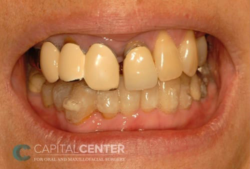 Case--7165 | Before Oral 1