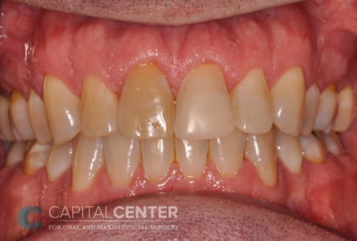 Case--8675 | Before Oral 1